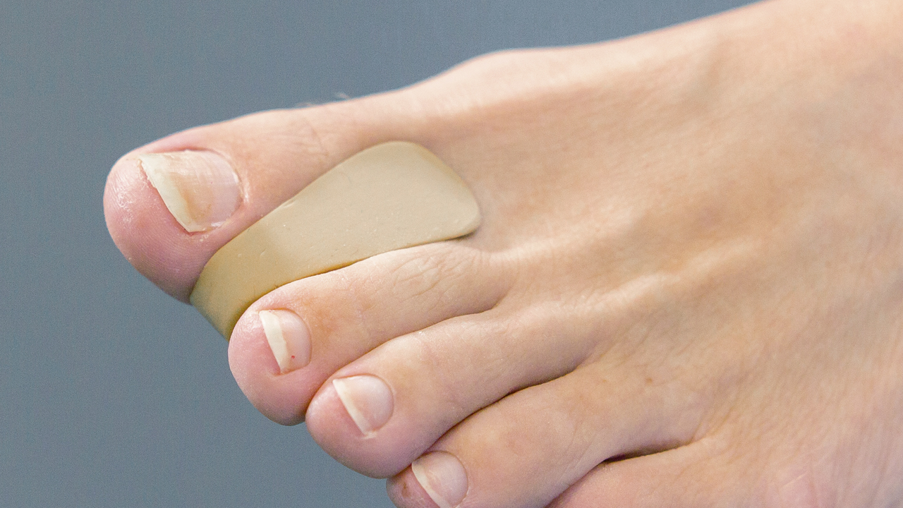 Pressure relief orthoses - intermediate toe wedge