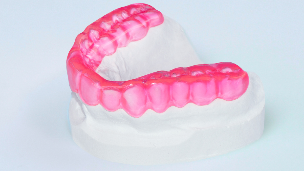 Occlusal splint / bruxism splint