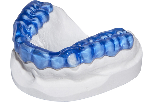 Bruxism splints