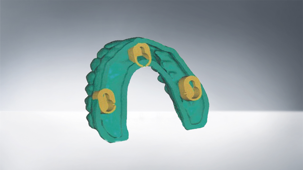 exMod-pro STL data hollow models