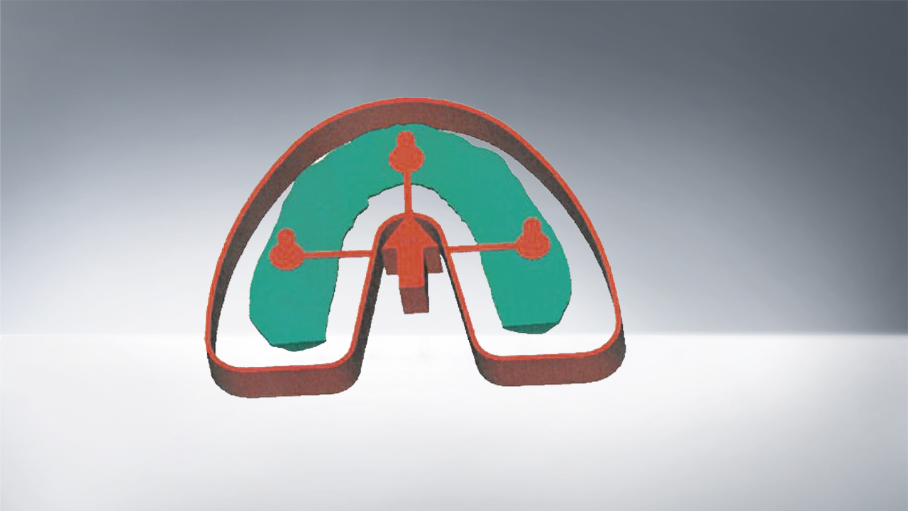 exMod-pro STL data solid models